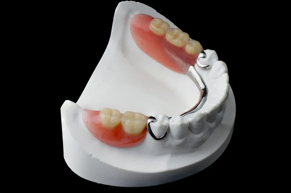 پروتز دندان و روشهای مراقبت از آن 5 Partial Dentures.jpg