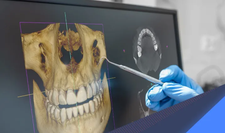 "عکس CBCT"