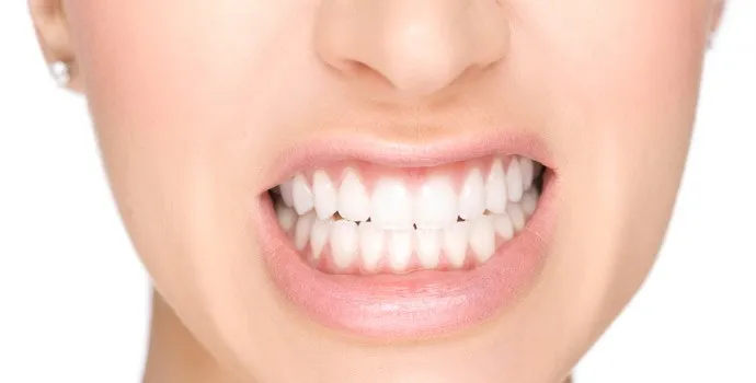 "بروکسیسم: وقتی دندانهایتان بیصدا فریاد میزنند!" 🦷 2 0 3 urumdental